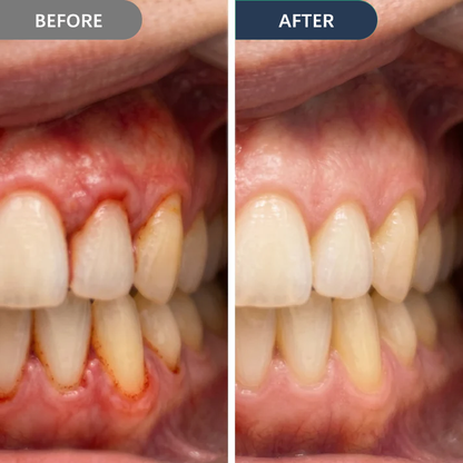 Novyado Gum Care Gel — Multi-Pack — image 3