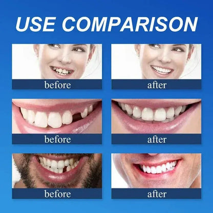 Novyado Custom-Fit Full Denture Set — source gallery 3
