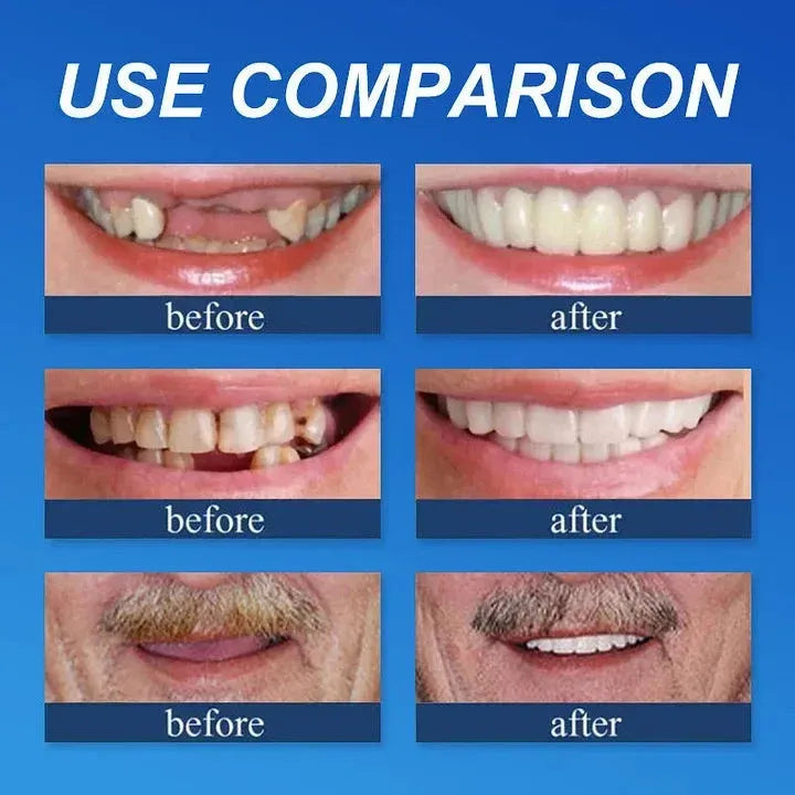 Novyado Custom-Fit Full Denture Set — source gallery 4