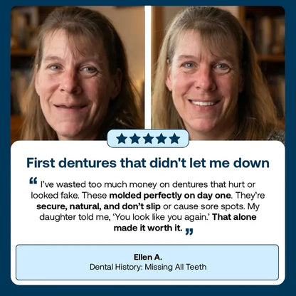 Novyado Custom-Fit Full Denture Set — source gallery 6